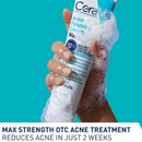 Acne Foaming Cream Wash